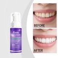 thumbnail image 3 of Stain Removal Brightening Teeth Foam, Oral Care Mousse for Whitening, Enamel Safe Cleaner for Smile – 60ml, 3 of 7