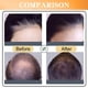 thumbnail image 5 of Spray para el crecimiento del cabello con agua de arroz 50 ml para hombres y mujeres - Nutrición del cuero cabelludo, tratamiento anticaída con biotina, aceite de ricino - Ingredientes naturales, 5 of 7