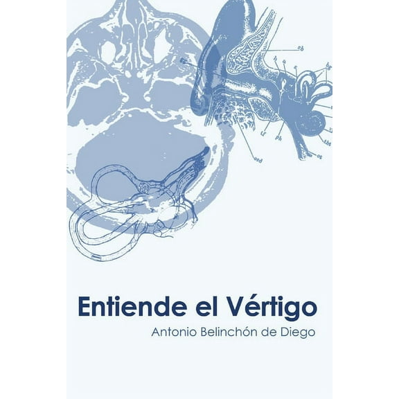 Entiende el vÃ©rtigo, (Paperback)