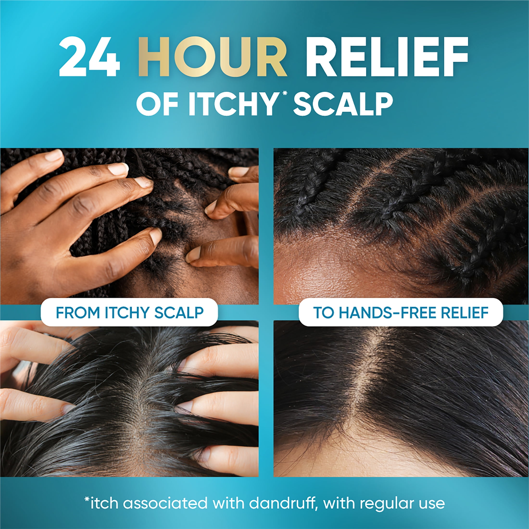 Head & Shoulders Royal Oils Instant Soothe Scalp Elixir Treatment, 4.2 fl oz, for Dry Scalp