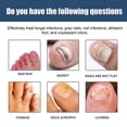 thumbnail image 4 of Clearance Antifungals Nail Treatments Spray In Medicals Quality, 30 Ml, Antifungals Nail Treatments, Antifungals Spray 30ml, 4 of 4