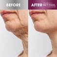 thumbnail image 4 of Crema reafirmante para cuello Retinol Antiedad 50 ml, 4 of 7