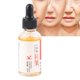 thumbnail image 1 of Cara 30ml Seis Péptidos Suero Facial Antiarrugas Antienvejecimiento Suero Hidratante Para El Cuidado De La Piel, 1 of 7