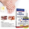 thumbnail image 2 of 1-3pcs Fungal Nail Treatment Highly Effective Kill Nail Fungus For Best Result, 2 of 5