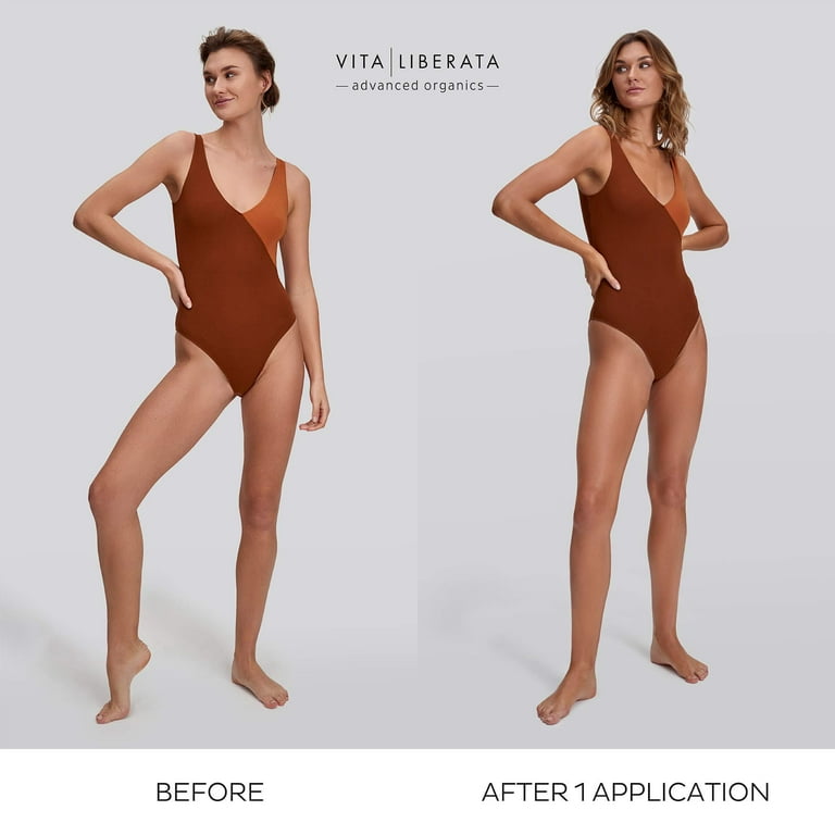 Vita Liberata's Body Blur Makes My Scars Disappear, Review, See Photos