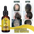 thumbnail image 3 of Ginger Infused Hair Growth Serum, Strengthening Repair Oil for Enhanced Vitality and Shine, Natural Solution for Thicker and Healthier Hair, 3 of 5