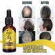 thumbnail image 3 of Ginger Infused Hair Growth Serum, Strengthening Repair Oil for Enhanced Vitality and Shine, Natural Solution for Thicker and Healthier Hair, 3 of 5