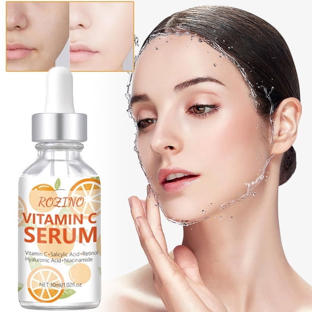 Fiudx Suero de Vitamina C, Esencia Iluminadora Reparadora de La Piel, Protección Antioxidante (30 Ml), Esencial Diario, Brillo Juvenil, Protección Ambiental