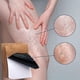 thumbnail image 5 of JAYSUING 12Pcs Varicose Veins Patches Skin-friendly Non-toxic Improve Varicosity Dredge Vein Relieve, 5 of 5