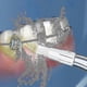 thumbnail image 3 of For Waterpik Water Flosser Waterpik Oral Irrigator Replacement Tips (6 Pack)_lucky_b, 3 of 4