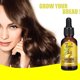 thumbnail image 3 of Ginger Hair Care Liquid Nourishing Hair, Moisturizing Hair Care, Glossy and Smooth Hair Care Nutrient Liquid, 3 of 5