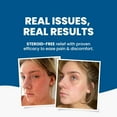 thumbnail image 6 of Grahams Natural C+ Eczema & Dermatitis Cream for Dry Skin & Itch Relief, Steroid-Free (4.23oz Tube), 6 of 8