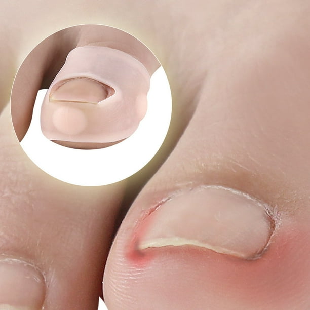 Herramienta para corregir uñas encarnadas Clip elástico para enderezar uñas Correctores de silicona para uñas de los pies