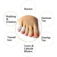 thumbnail image 3 of Roofei 10 Pack Pinky Toe Sleeves Protectors, Toe Covers, Protect Toe from Corns, Blisters and Other Painful Toe Problems (White), 3 of 6