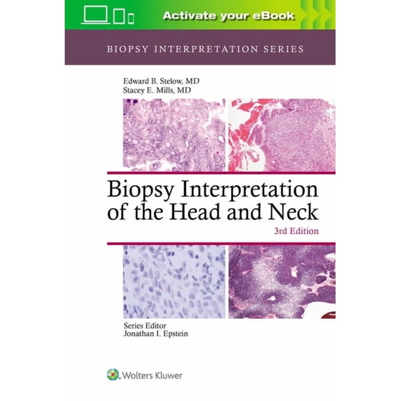 Biopsy Interpretation: Biopsy Interpretation of the Head and Neck (Hardcover)