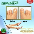 Fungisolve Nail Clarifying clears out keratin debris where nail