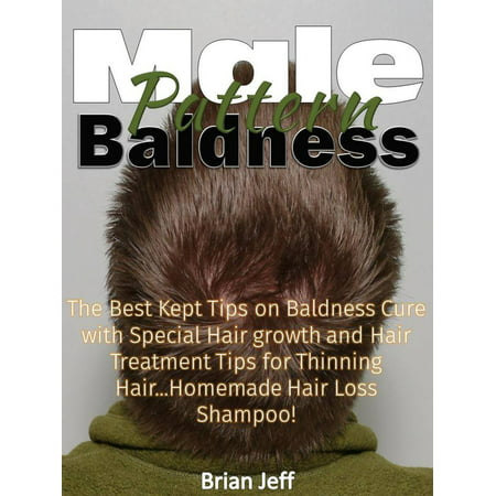 Male Pattern Baldness: The Best Kept Tips on Baldness Cure with Special Hair growth and Hair Treatment Tips for Thinning Hair...Homemade Hair Loss Shampoo! - (Best Treatment For Thin Frizzy Hair)