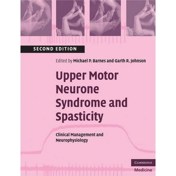 Cambridge Medicine (Paperback) Upper Motor Neurone Syndrome and Spasticity, (Paperback)