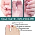 thumbnail image 3 of 1-3X 2025 Nailner Brush Against Nail Fungal Infection 2 in1 treat & brighten nails, 3 of 5