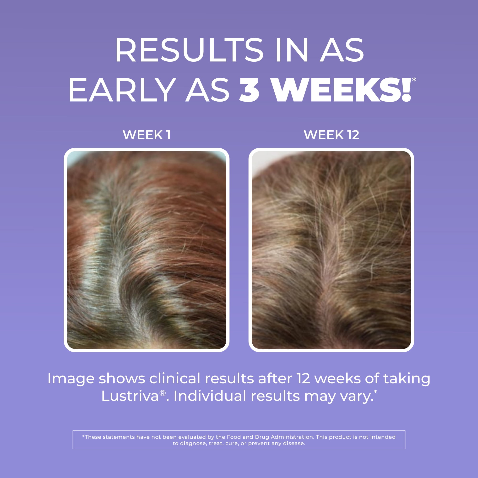 MaryRuth's Hair Growth Max Liposomal, Ultra Absorption, Contains Lustriva, 7.6 fl oz, Almond Cookie