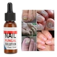 thumbnail image 3 of Tratamiento De Hongos En Las Uñas, Tratamiento De Hongos En Las Uñas, Solución De Cuidado De La Salud Para Hongos En Las Uñas De Los Pies Y Pies De Atleta, 3 of 7
