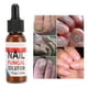thumbnail image 3 of Renovación Fungal Renovación De Uñas Hungus Para El Tratamiento De La Uña Solución De Atención Médica Para El Atleta De Los Dedos De Los Dedos, 3 of 7