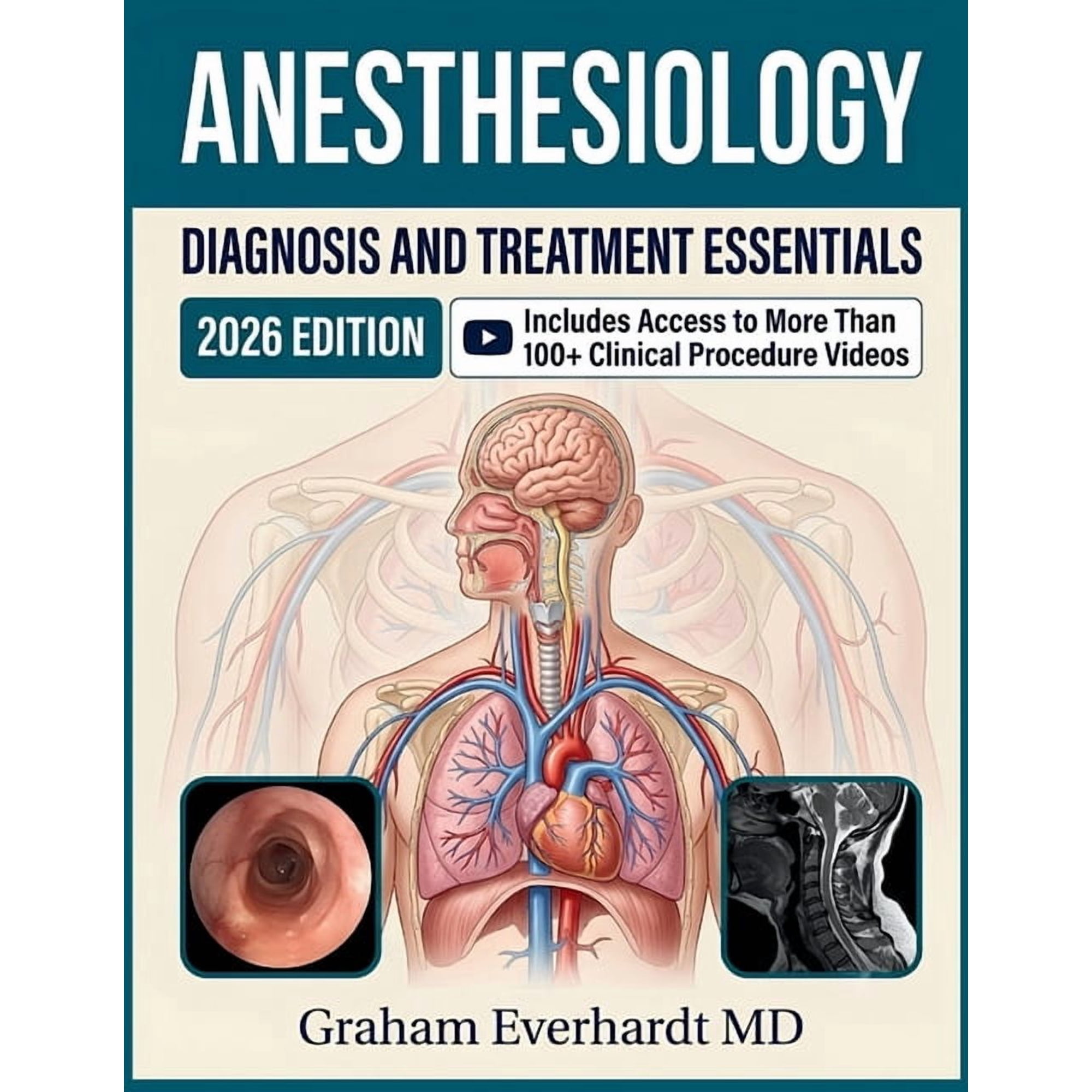 Anesthesiology Diagnosis and Treatment Essentials: A Clinical Guide to Perioperative Assessment, Airway Management, and , (Paperback)