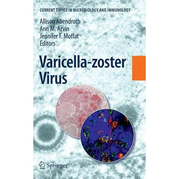 Current Topics in Microbiology and Immmu Varicella-Zoster Virus, Book 342, (Hardcover)