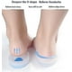 thumbnail image 2 of 3 pares de plantillas de gel para fascitis plantar: almohadillas de gel de silicona para el talón para el dolor de talón y espolón óseo, 2 of 4