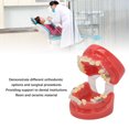 thumbnail image 4 of Modelo de Ortodoncia Soporte de Cerámica de Alambre de Metal ANGGREK 24 Dientes, 4 of 7