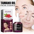 thumbnail image 1 of XWSHYW Esencia El Aceite Facial Reduce La Pigmentación, Aclara Las Cicatrices y Las Líneas Finas y Es Adecuado para Mujeres con Todo Tipo de Piel de 30 Ml., 1 of 6