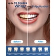thumbnail image 4 of Kit de Blanqueamiento Dental MySmile con Gel 35% CP 5 LED, 4 of 9