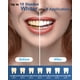 thumbnail image 4 of Kit de Blanqueamiento Dental MySmile con Gel 35% CP 5 LED, 4 of 9