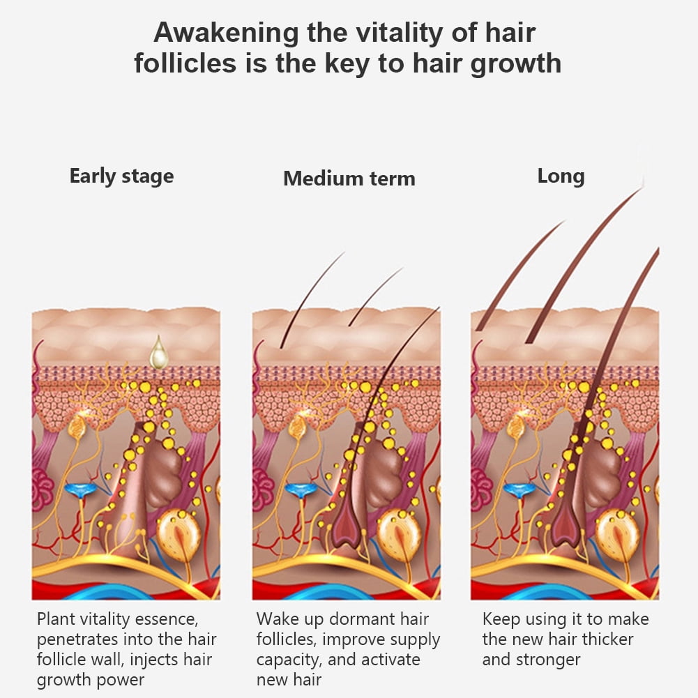 60ml Home Anti Loss Stronger Thicker Men Women Hair Growth Serum Scalp Treatment 60ml Home Anti Loss Stronger Thicker Men Women Hair Growth Serum Scalp Treatment