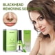 thumbnail image 1 of Esencia para Eliminar Puntos Negros (10 Ml + 50 Pegatinas) | Kit Limpiador y Rehidratante | Limpiador de Poros y Eliminador de Melanina | Set de Regalo para Una Piel Suave y Firme, 1 of 7