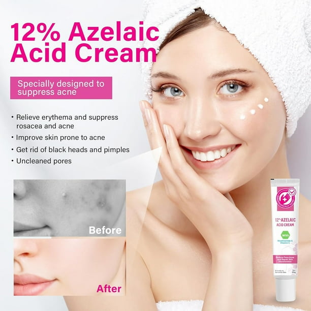 Azelaico 12% Acné Crema: Premium Azelaic Crema Facial - Alivio de enrojecimiento de la cara, enrojecimiento de la reducción de cuidado de la piel, evitar los brotes de acné, Ease Pimple,20g