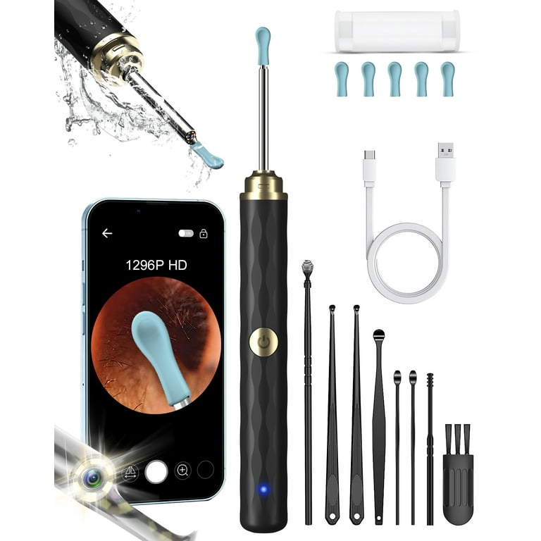 Kekoy Ear Wax Removal Kit, Ear Cleaner with Camera, 5 Megapixels 1080P Ear  Scope, Wireless Otoscope Ear Cleaning Kit with Lights and 6 Ear Scoops, Ear  Camera for iPhone, iPad, Android Phones 