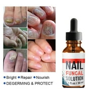 YX STORE 10ml/20ml/30ml Anti Fungus Liquid Toe Finger Nail Infection Repair Treatment