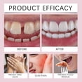 thumbnail image 2 of Adhesivo Termoplástico para Dentaduras Postizas Sin Pegamento Duradero El Cuidado Las, 2 of 8