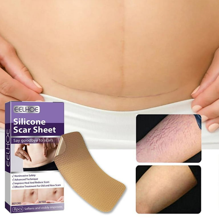 4 Pack Silicone Scar Sheets, Strips, Tape - Keloid, C-Section, Surgical -  Scars Removal Treatment - Silicon Gel Cream Patch Bandage - Tummy Tuck  Surgery - 31.6 