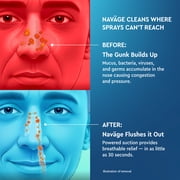 مجموعة Navage Nasal Care ESSENTIALS: منظف الأنف Navage، وحامل سطح الطاولة، و30 كبسولة SaltPod.