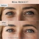 thumbnail image 4 of Anti-Aging Eye Treatment with Retinal and Niacinamide to Reduce Puffiness, Smooth Fine Lines, and Brighten Dark Circles, 30ml, 1 fl.oz, 4 of 5