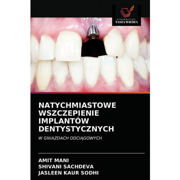 Natychmiastowe Wszczepienie Implantów Dentystycznych (Paperback)
