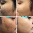 thumbnail image 5 of 10% Vitamin C Face Serum by Pilgrim | Anti Aging Facial Serum with 5% Niacinamide & Kakadu Plum | Reduces Fine Lines, Smooths Skin Texture & Improves Radiance | 1.01 Fl Oz (30ml), 5 of 8