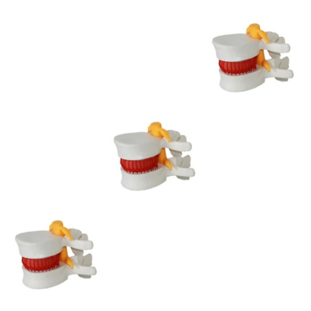 Youkk Easy-to And Effective Teaching Tool Wide Application Lumbar Vertebrae white 3Set