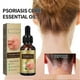 thumbnail image 2 of 2025 Psoriasis Dandruff Treatment for Scalp, Anti Itching Follicle Booster Stimulator Smoothing Nourishing Hair SerumZZ16, 2 of 5