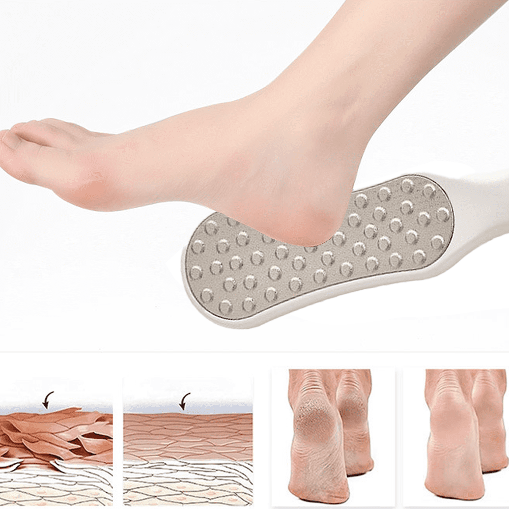 Foot File Callus Remover for Feet, Feet Filer for Dead Skin, Double Side  Metal Foot File Stainless Steel, Foot Scraper to Remove Hard Skin, Birthday