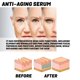 thumbnail image 4 of Collagen anti-aging essence to reduce fine lines and nasolabial folds, moisturizing and anti-wrinkle serum, 4 of 4