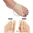 thumbnail image 5 of Pinkiou Bunion Relief Sleeve Lycra Fabric Hallux Valgus Gel Pads Bunion Separator Cushion Protector Sleeves, 5 of 6