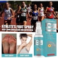 thumbnail image 3 of Athlete's Foot Spray Athlete's Foot Spray Effectively Resolves Foot Itching And Inflammation For Athlete's Foot Foot Sweat And Foot Odor 50ml, 3 of 5